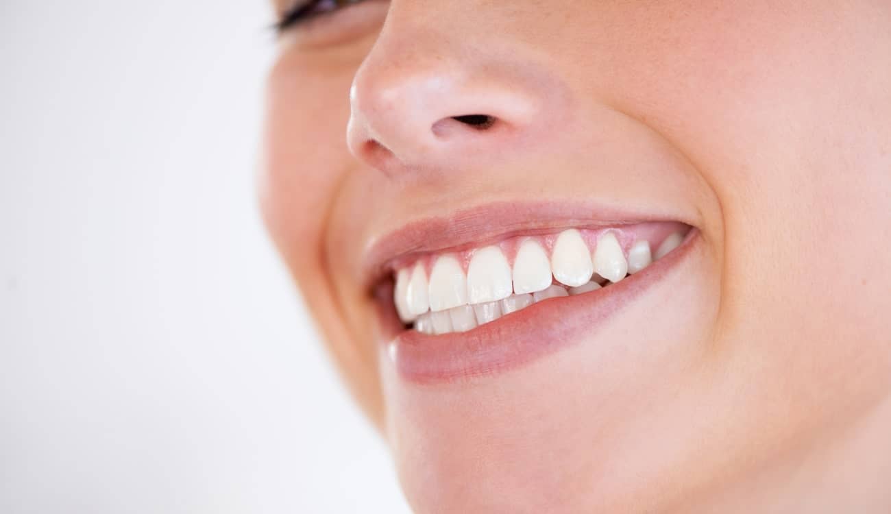À quoi servent les facettes dentaires ? Et dans quel cas en a t'on besoin ?