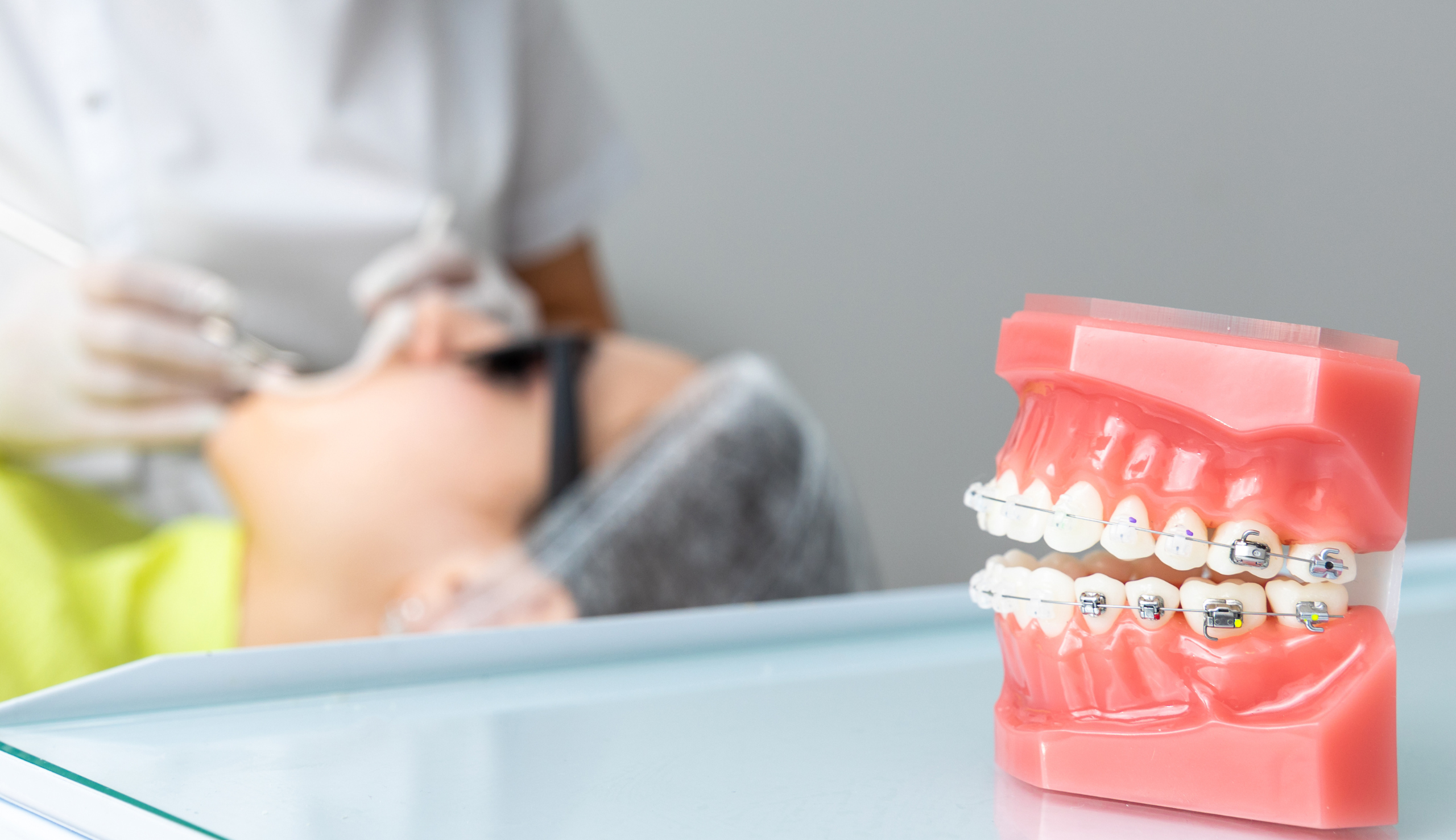 Alignement dentaire : causes, Clinique dentaire Sana Oris